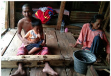 Warga Miskin Ujung Lamuru Dipasung Hampir 2 Tahun dan Merasa Tersiksa!