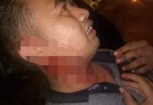 Berkelahi di Tarengge, Satu Orang Dilarikan ke Rumah Sakit