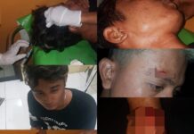 Gegara Miras, Perkelahian Pemuda Kembali Terjadi di KalaenaÂ