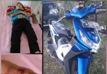 Diserempet Pick Up, Warga Kecamatan Bengo Dilarikan ke RSUD Tenriawaru Bone