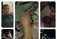 Lakalantas di Bengo, Kaki Pelajar SMA 5 Bone Patah