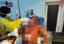 Diduga Ditebas, Korban Mengalami Luka Robek di Leher