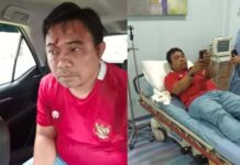 Haris Pertama Ketum DPP KNPI, Duga Pelaku Pengeroyokan Dirinya Orang Kuat dan Banyak Duit