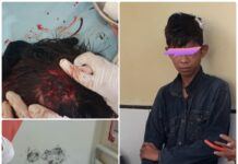 Anak Dibawah Umur di Bone Dikeroyok Puluhan Pelajar, Korban Sempat Hilang Kesadaran