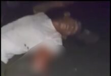 Warga Lamasi Kena Petasan, Jari Tangan Hancur