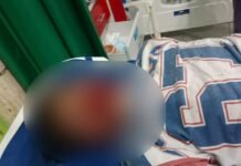 Pengendara Motor Tabrak Mobil Truck di Kalaena, Identitas Korban Belum Diketahui