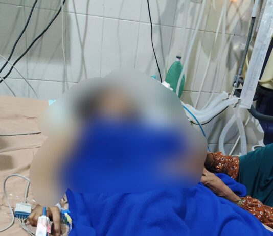 Kondisi Korban KDRT Asal Sorowako Kritis di RSUD I Lagaligo